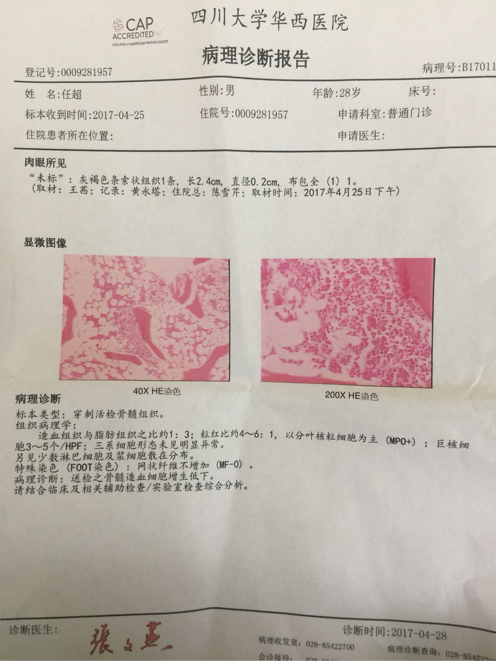 091830ieeulhb9exlpxljx.jpg