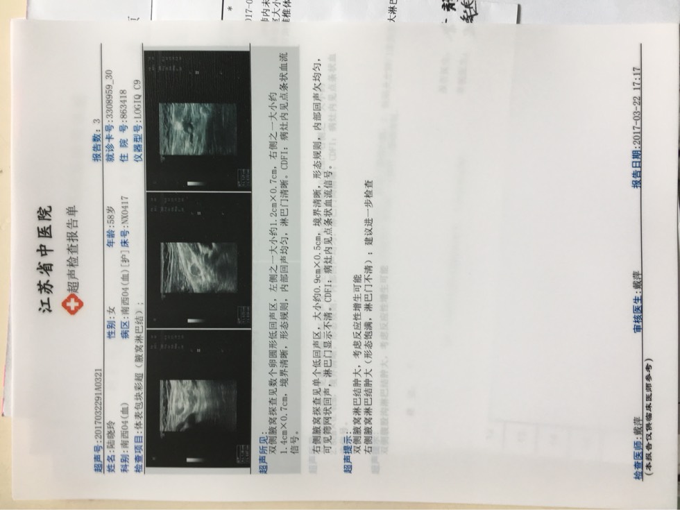 235728qq7gl3vyzqv3dfk3.jpg