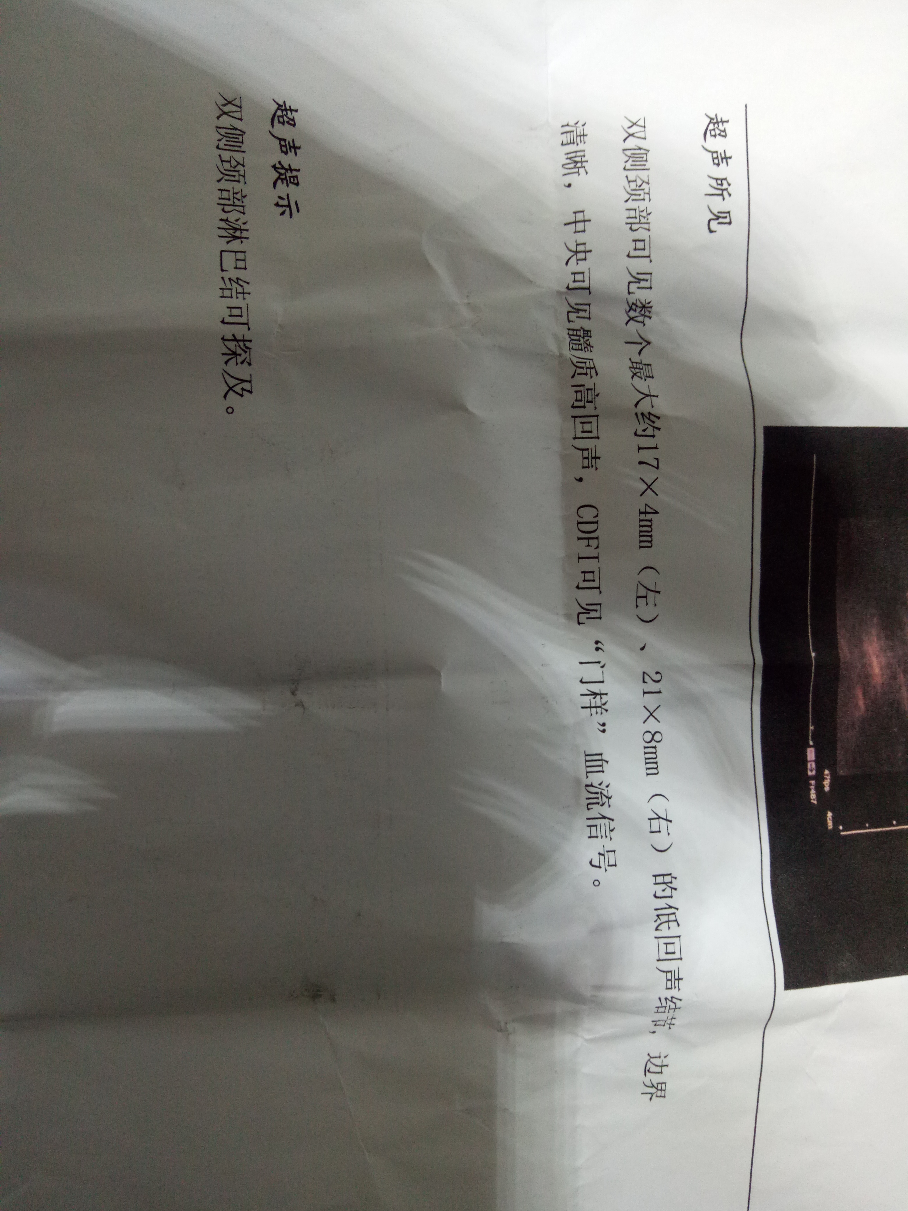 IMG20170516195549.jpg