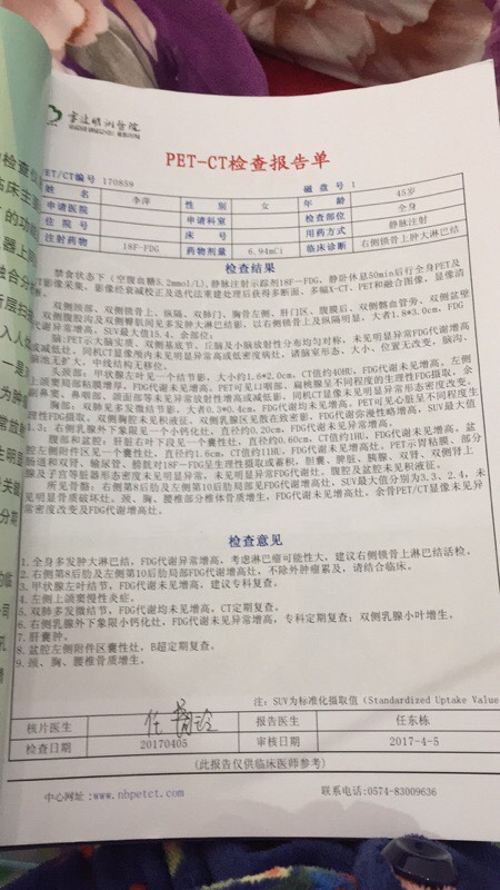 054456nqo51fxpq14d44qf.jpg