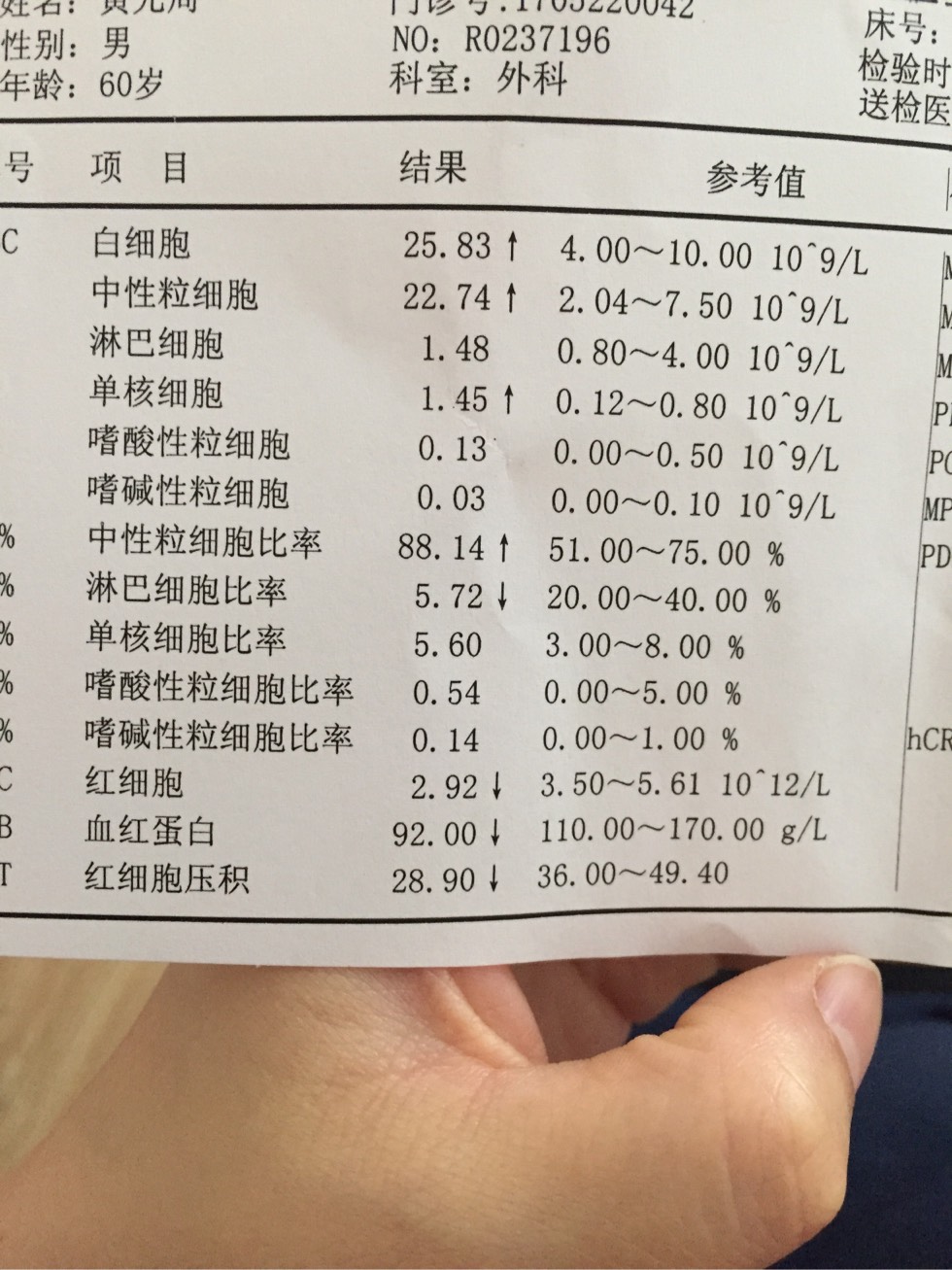 114445q1j42pwkh9jus9fw.jpg