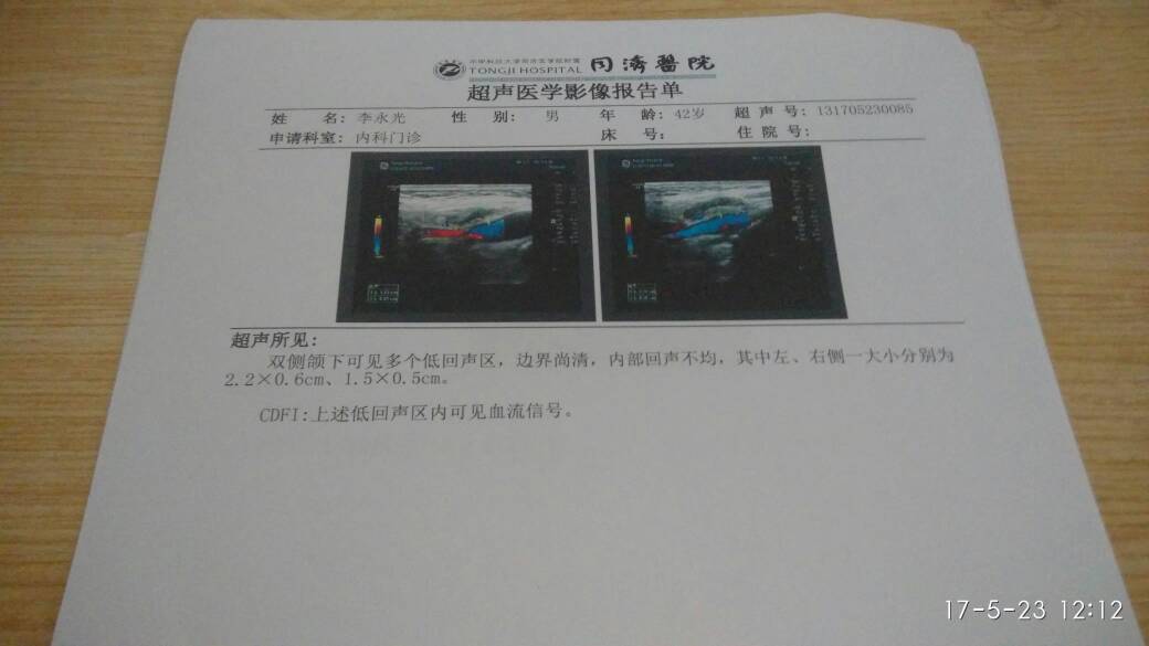 182415r2nhe2meun93ezbb.jpg