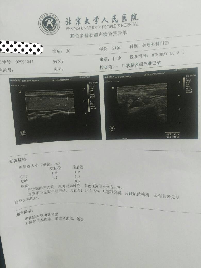 143839bma3u5v6jzsj4jmp.jpg
