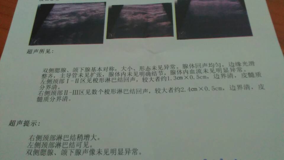 120503lntk03k0dvl8df97.jpg