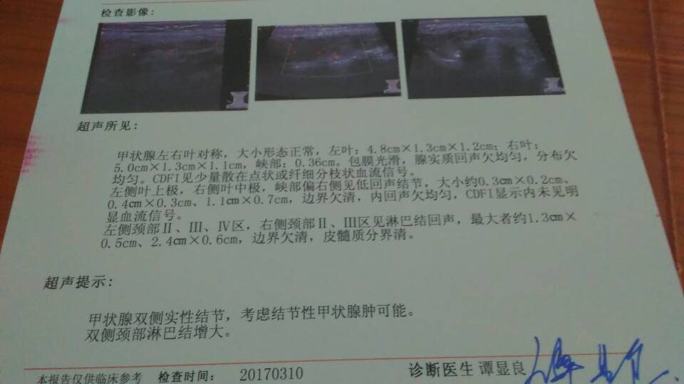 120504afnn73kq3dckh7in.jpg