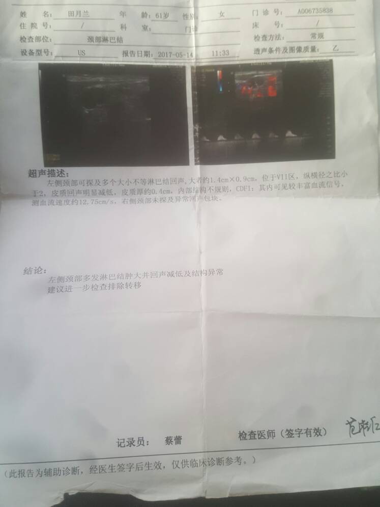 183809akqtholpthctttqt.jpg