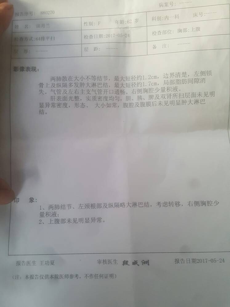 183810y3zsqzqqnmaq3q1q.jpg