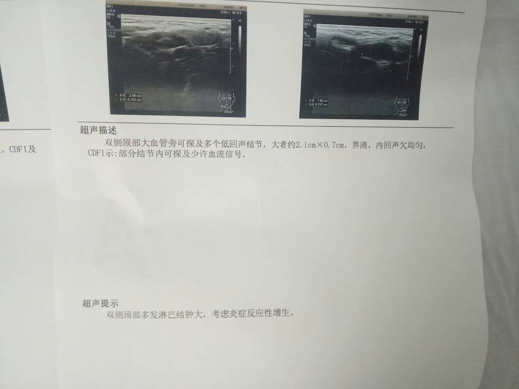 150945zwm52eqf3o822seo.jpg