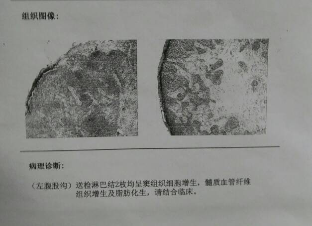 164548vzjmnrqlh82clmbb.JPG