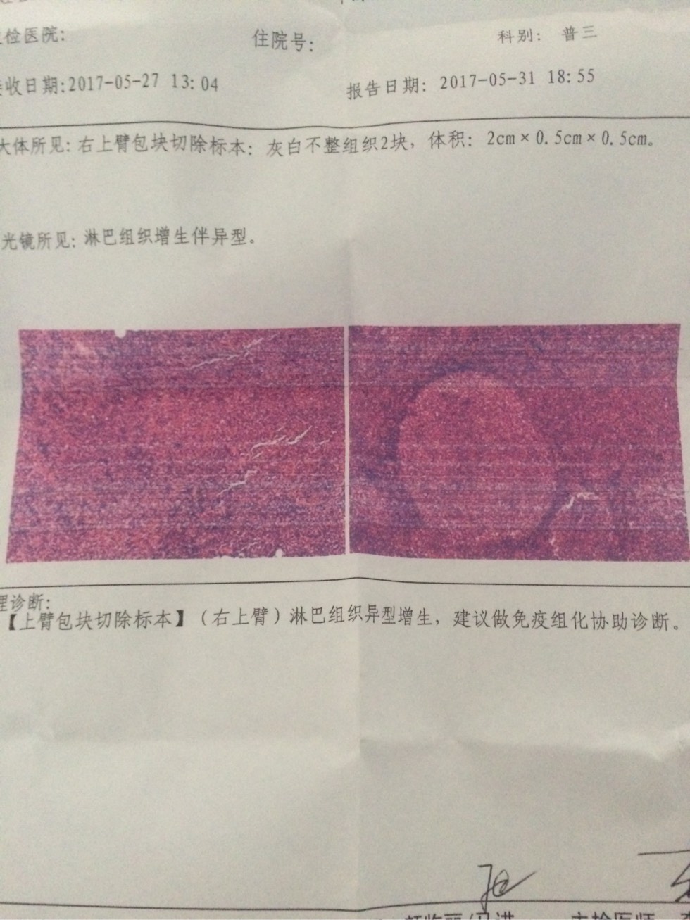 173730rsdk8n7xsedndrzr.jpg