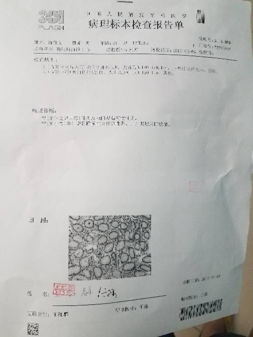 221549kog4b4ggg1oy48gt.jpg