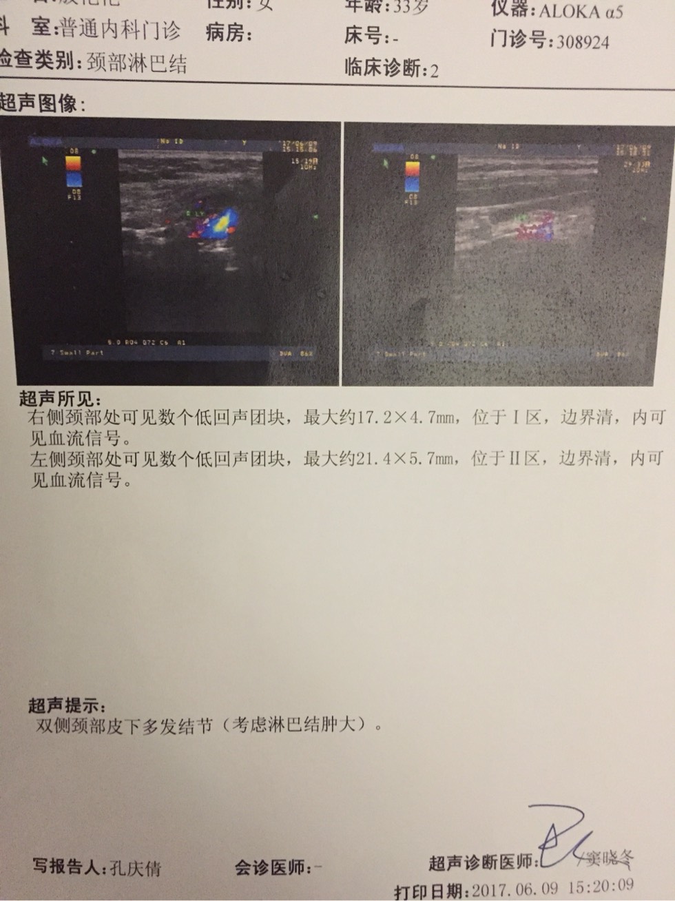我全身淋巴结肿大咳嗽胸疼低热乏力求助大家