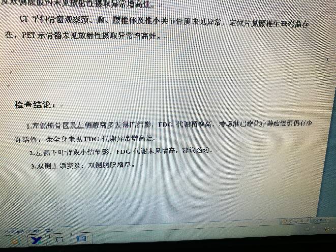 123237al92alwxbx5amv5h.jpg