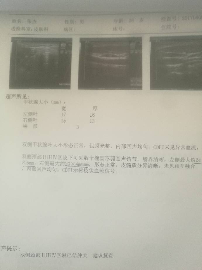 190428f0en3ea9b0g9770j.jpg