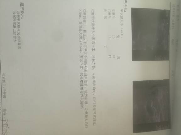 190428uqd28cpupqzzudbz.jpg