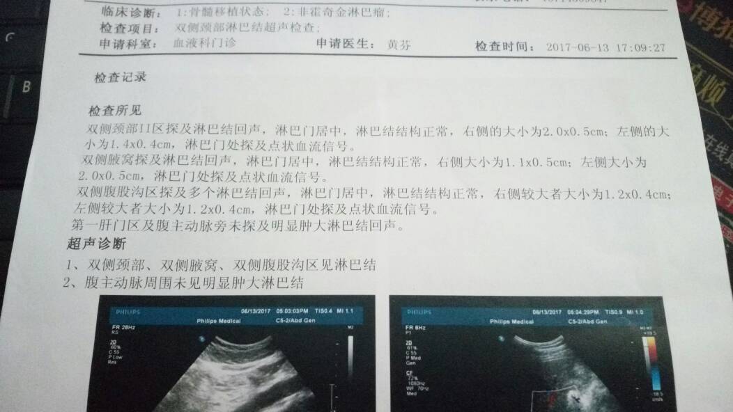 215412ic9d9huvz29pttit.jpg