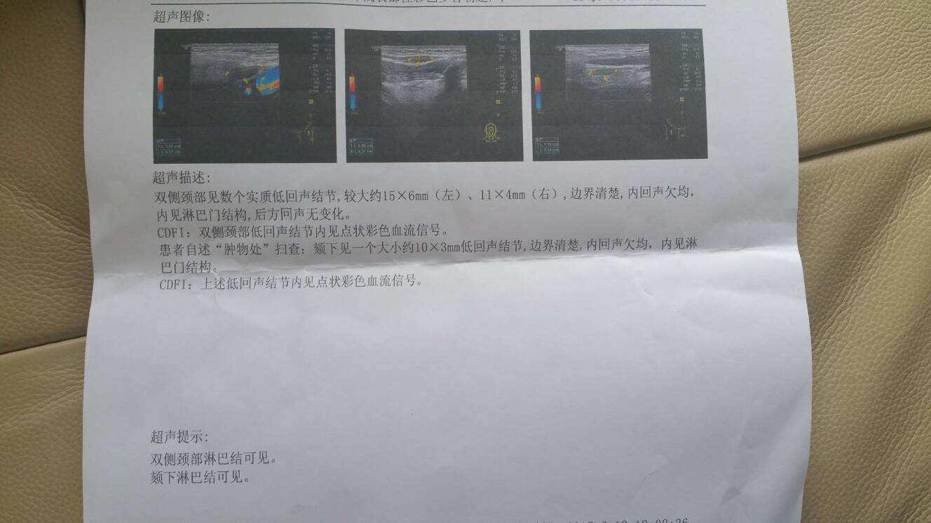 131247lv2omcofxqfeezkf.jpg
