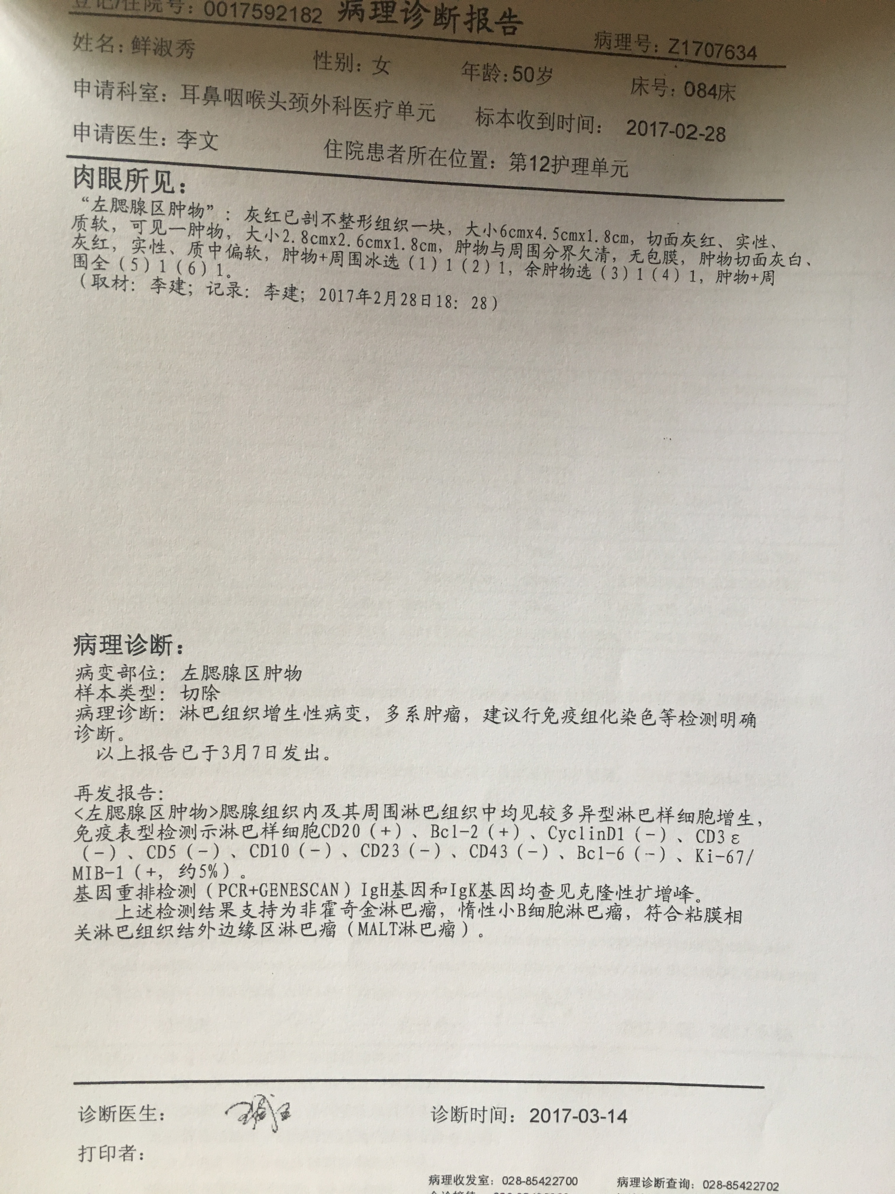 腮腺淋巴瘤