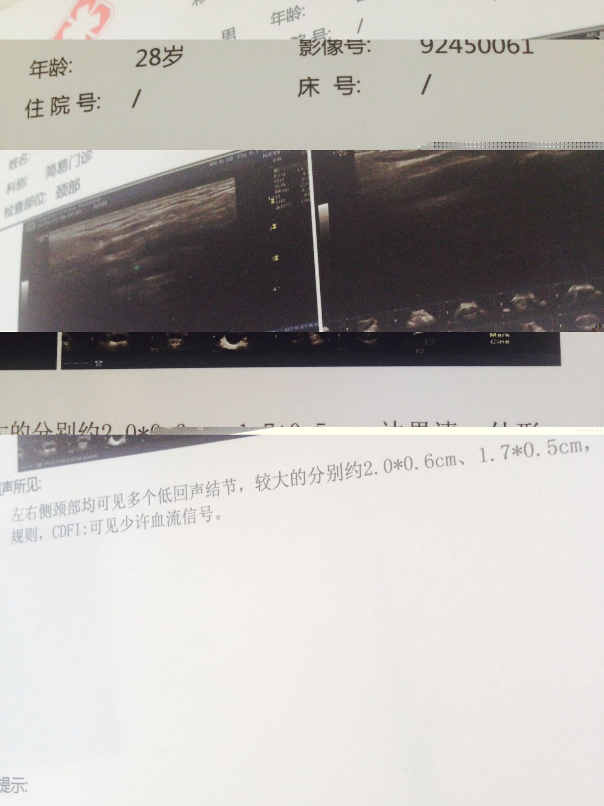 113359lhmxhi8h0zh8h7xm.jpg