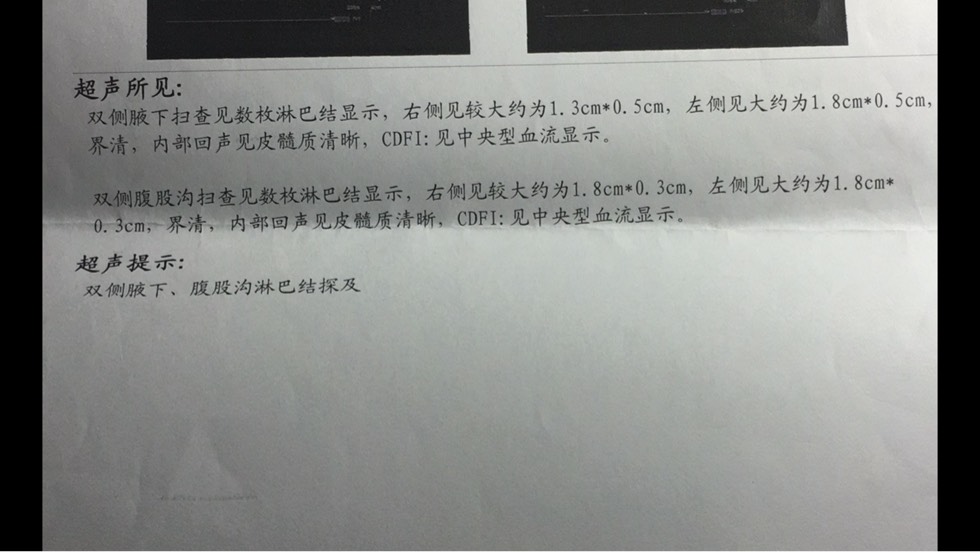 103220aa338wswfs8837gr.jpg