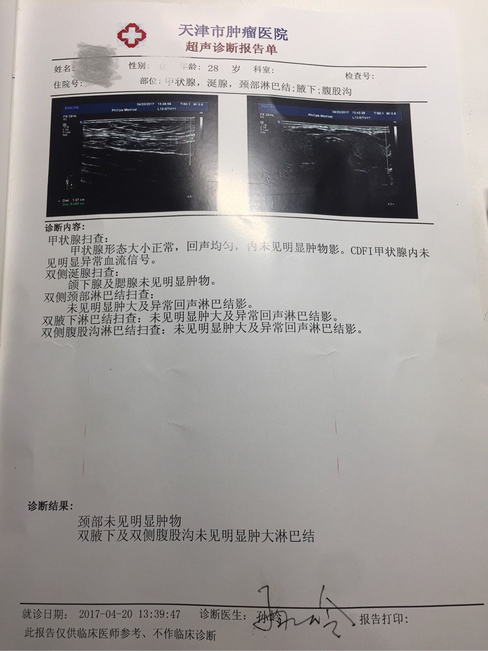 182041xyqu5gu813bgf6ef.jpg