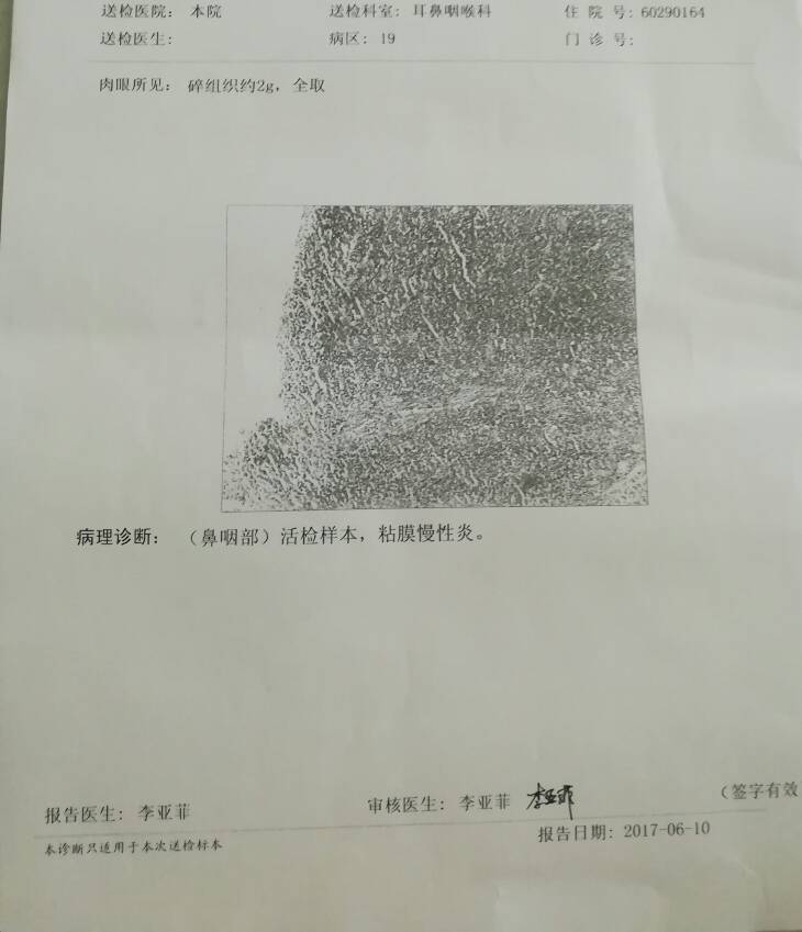 095737tkaouzzr0gskk4au.jpg