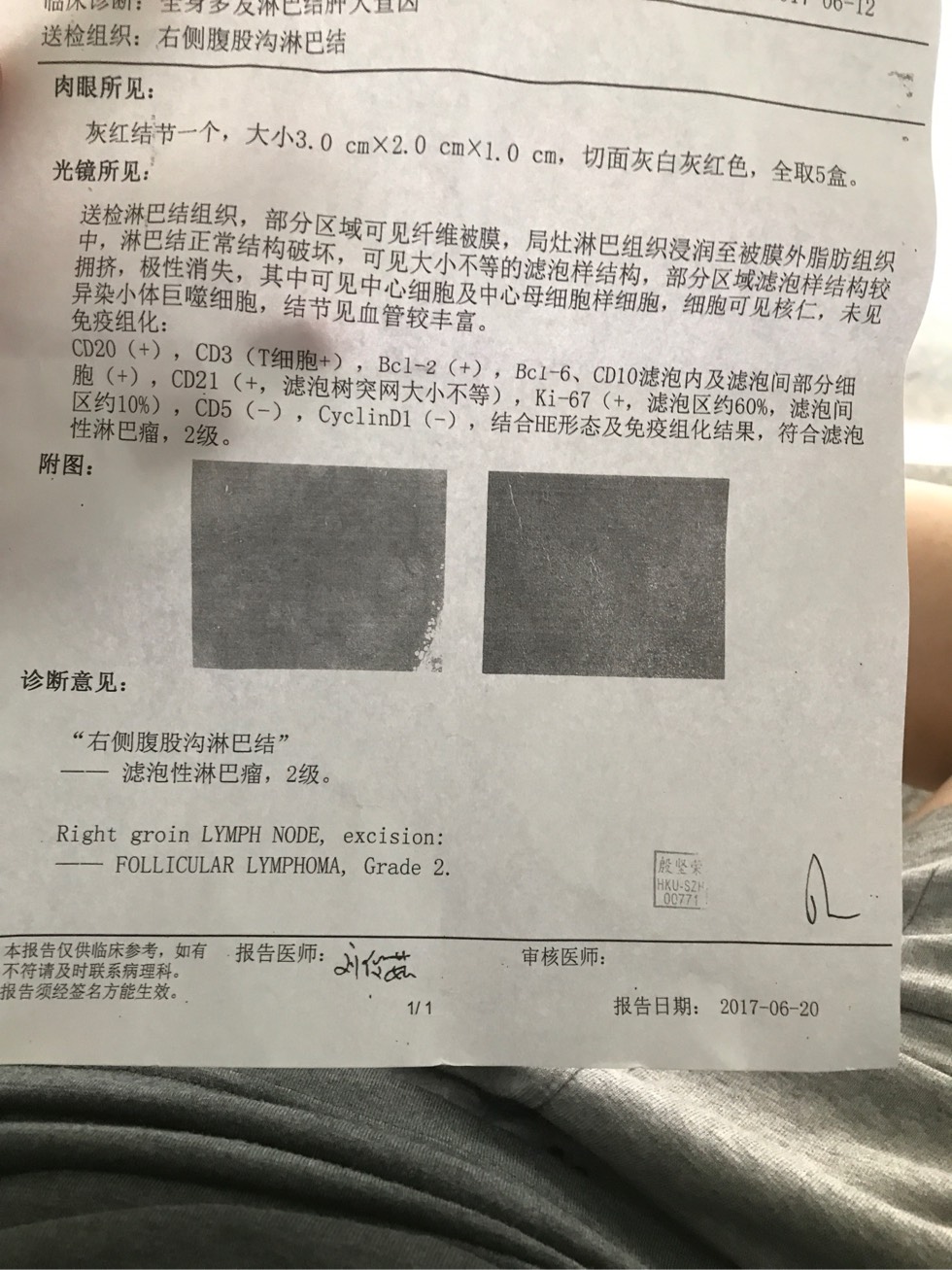 122923sze18z1aisma1n0e.jpg