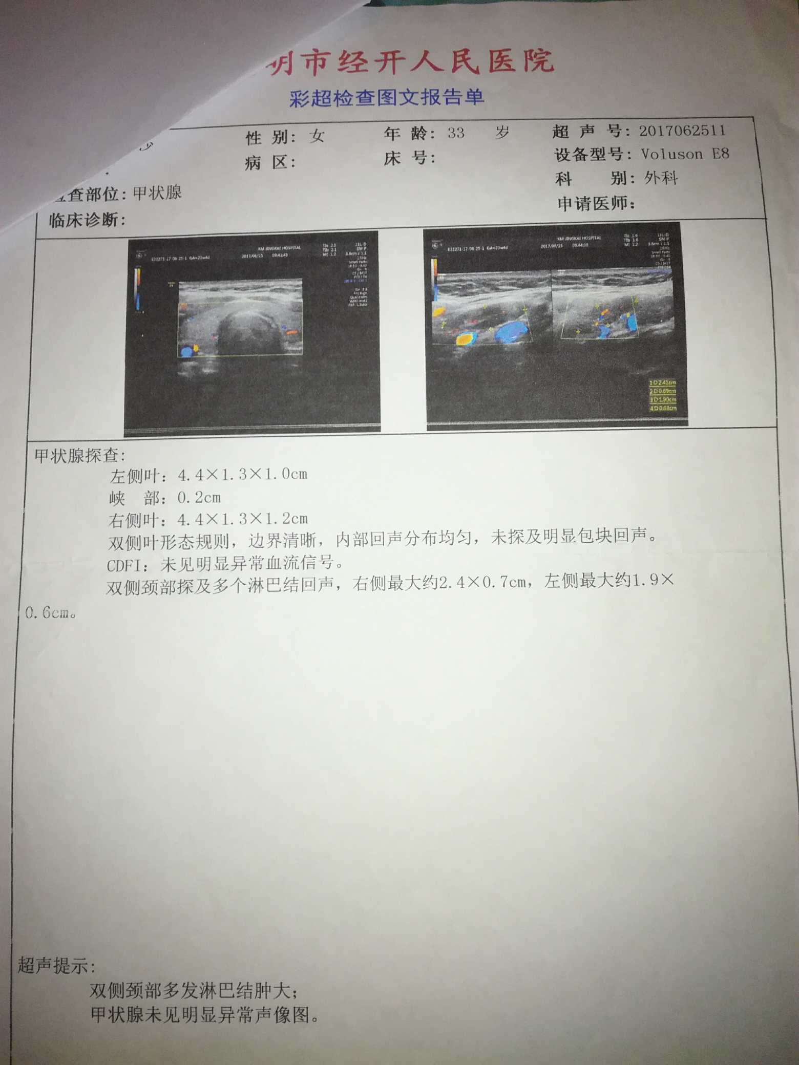 231457g9m0909mnmjuzr5p.jpg