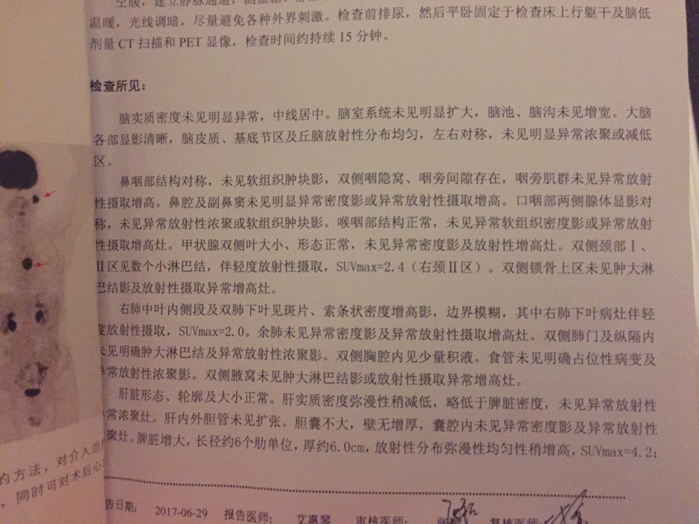220856oo5imdo99zawo5ic.jpg