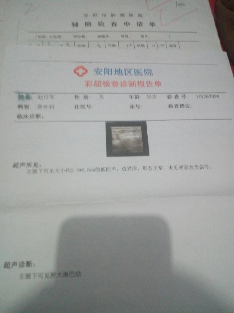 015518qb911fho7d2co0x9.jpg