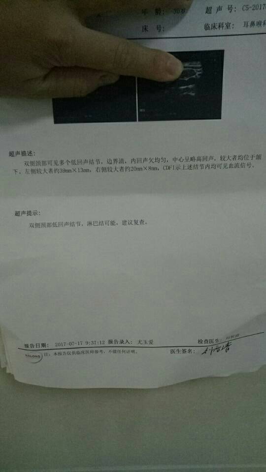 113133xzpepm5zdp2pwpmp.jpg