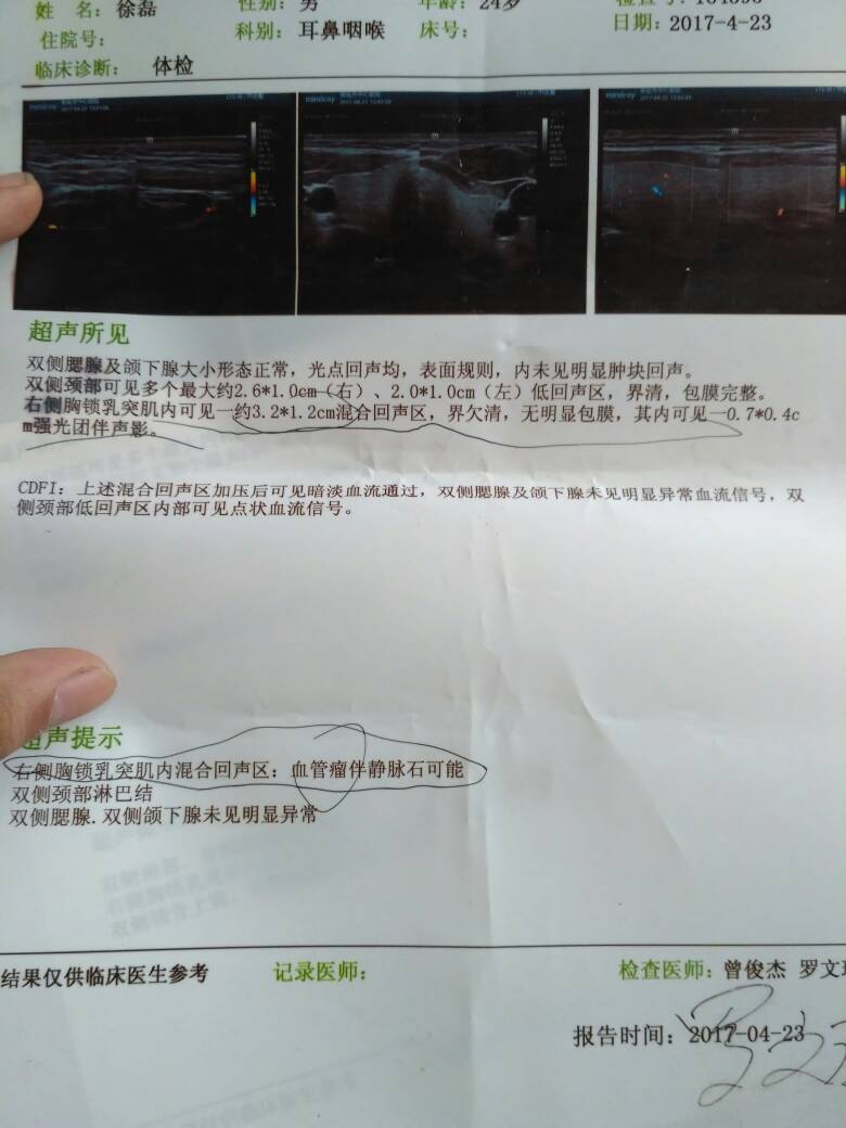 115151n623izpiy0x56bbp.jpg