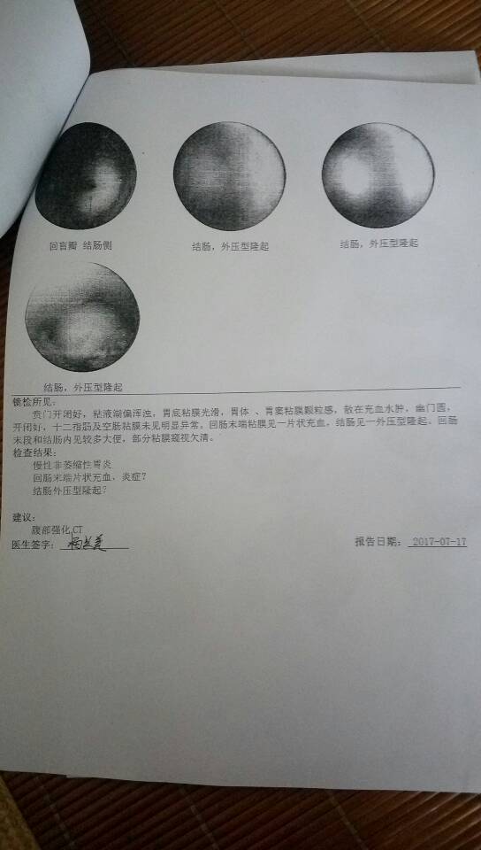 145037kmccdk1n44nued4j.jpg