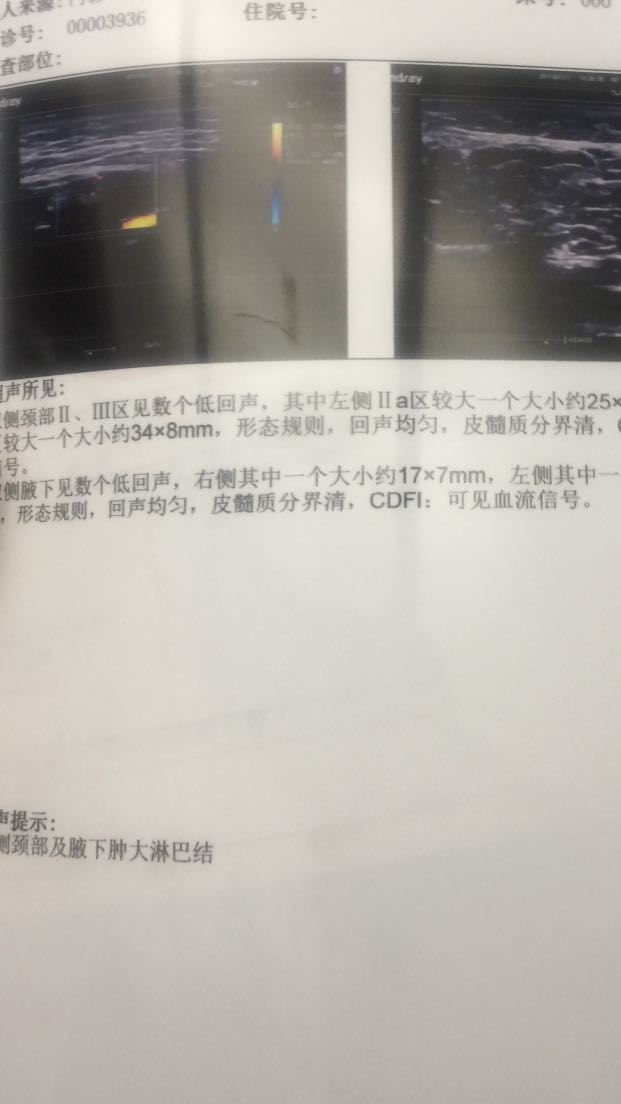 033611x6gl26l7bk6rxgk7.PNG