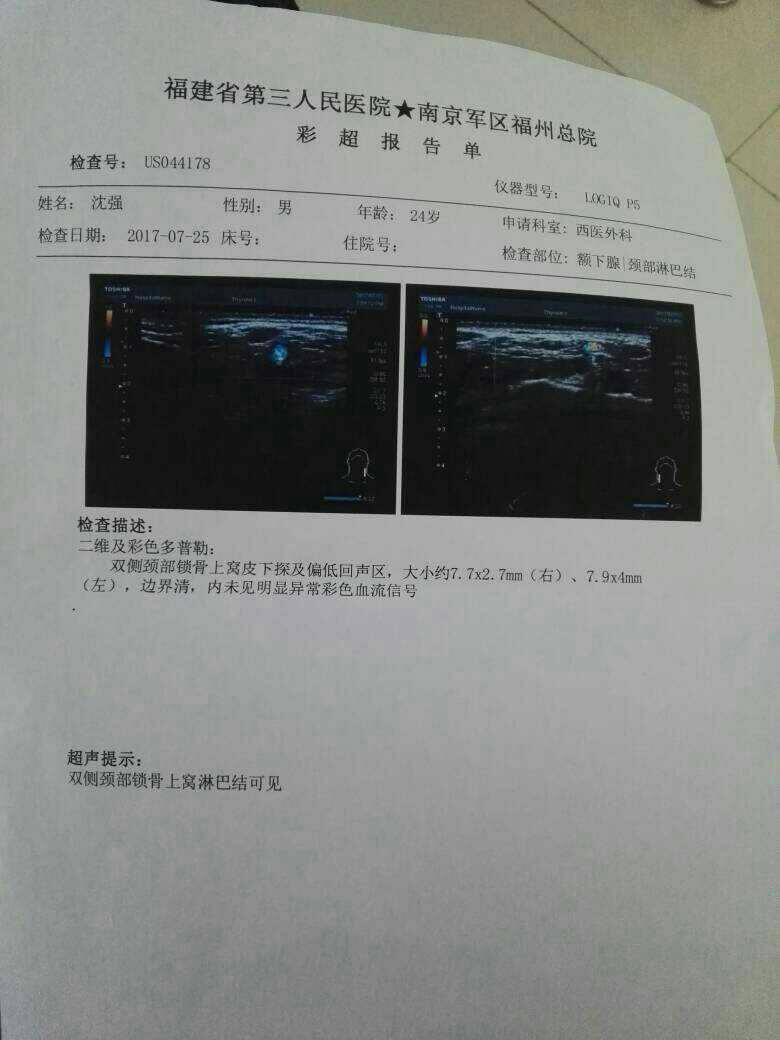 010347njlpllprnifprvvk.jpg
