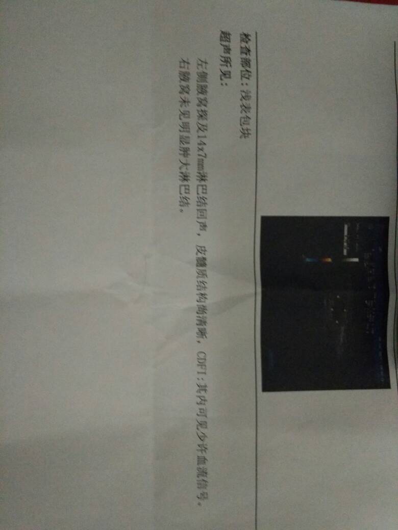 083859fjmkppp1ej53eeim.jpg