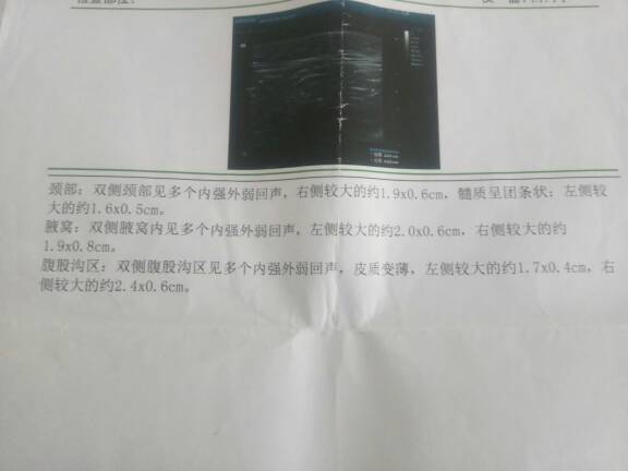 161543sd99dhxo85rz35b9.jpg