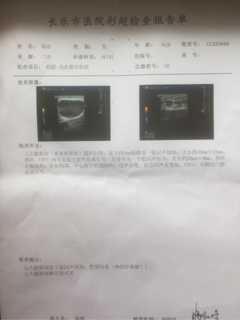 221319dhh4jh75ckhtmj42.jpg