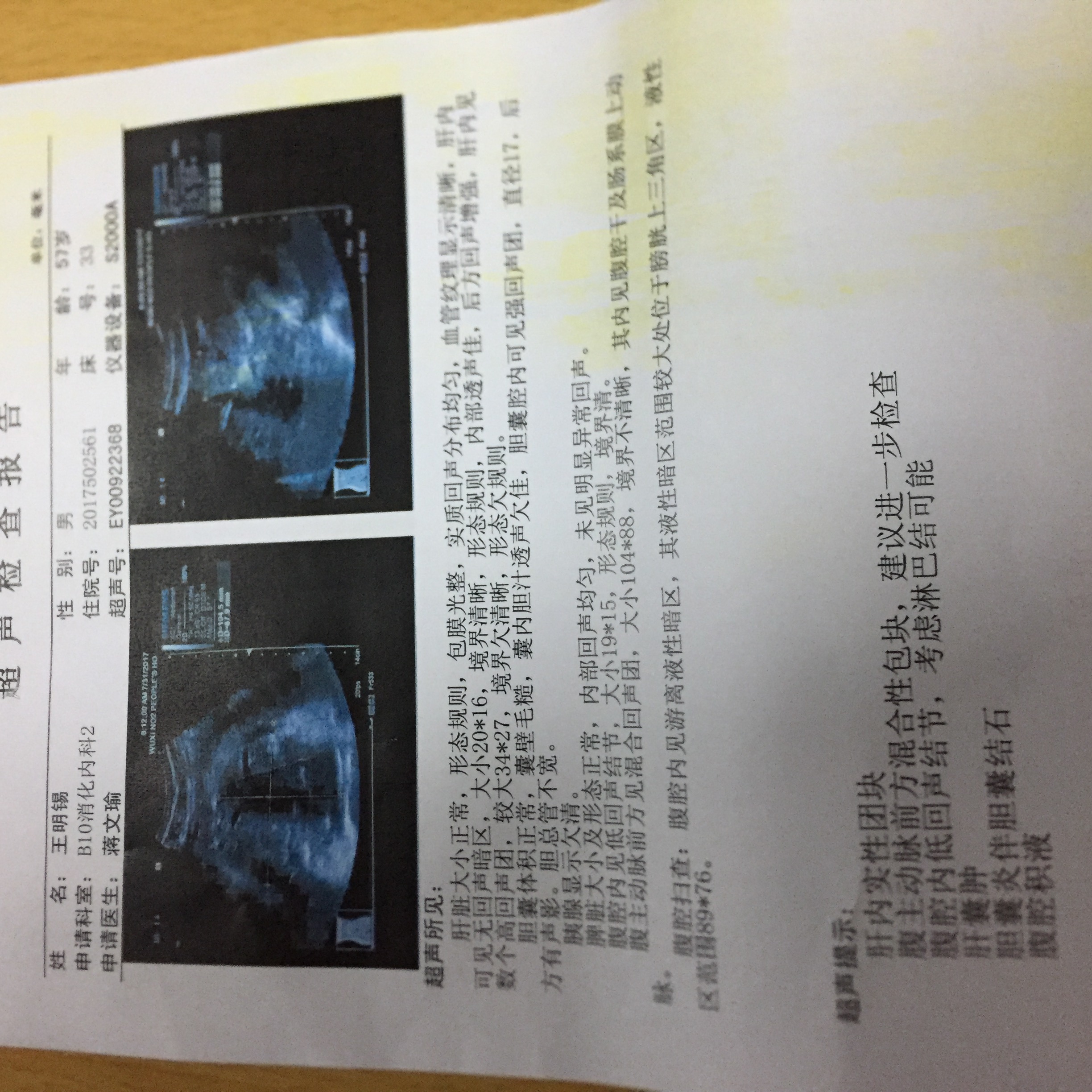 B超报告