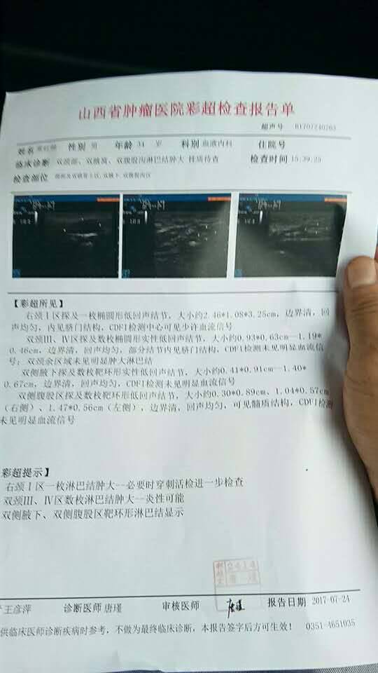 095106w8ctqituluhujiwt.jpg