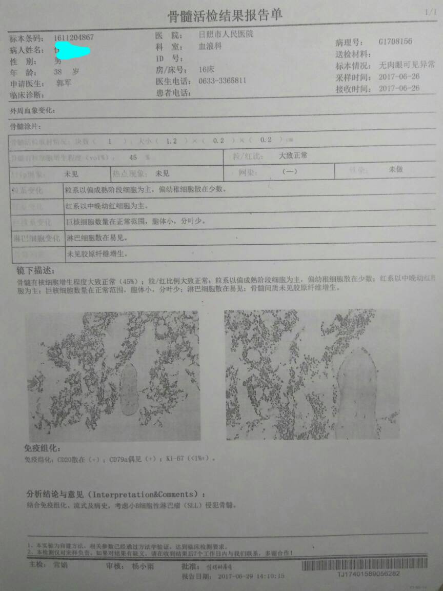 105947ml05g25z62cdigl5.jpg