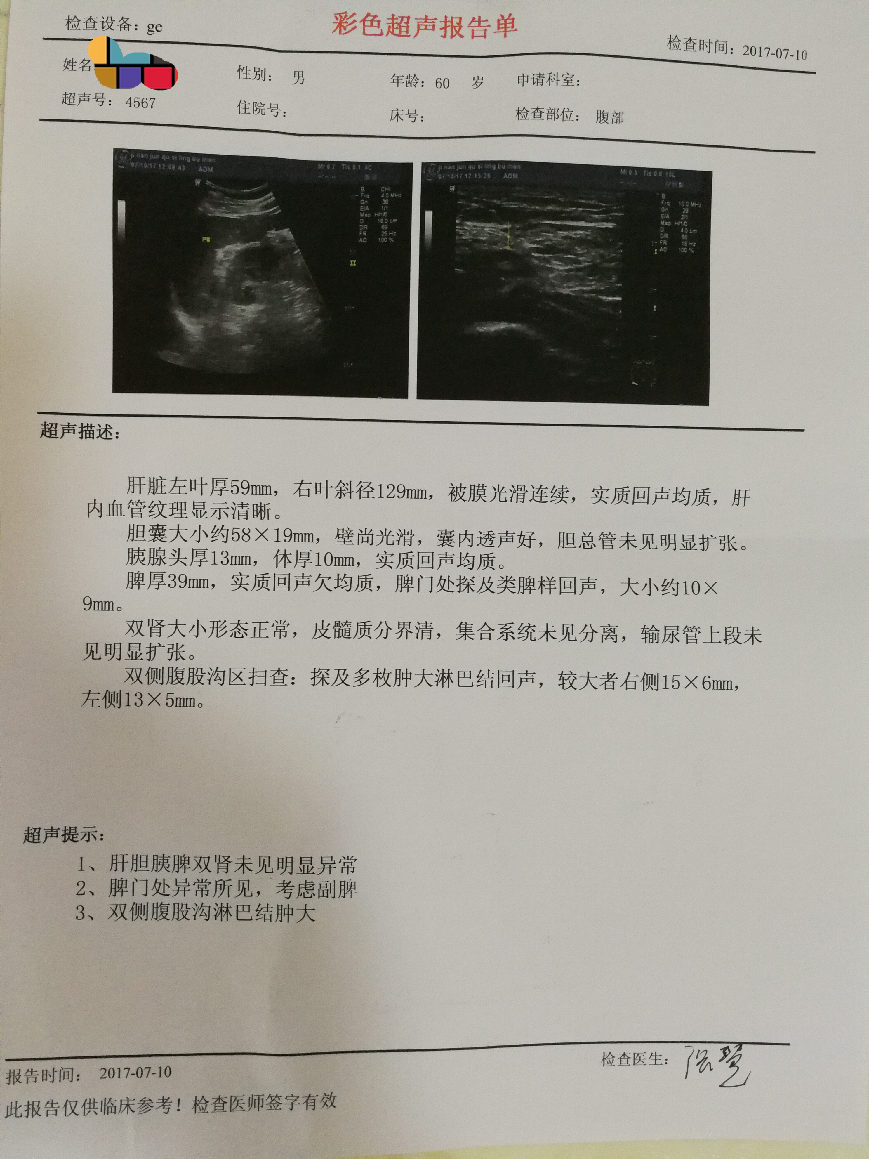 淋巴瘤之家发帖IMG_20170710_113547.jpg