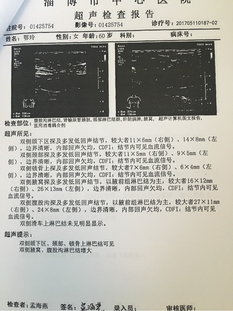 093956f91n9kk19dd1jwl9.jpg