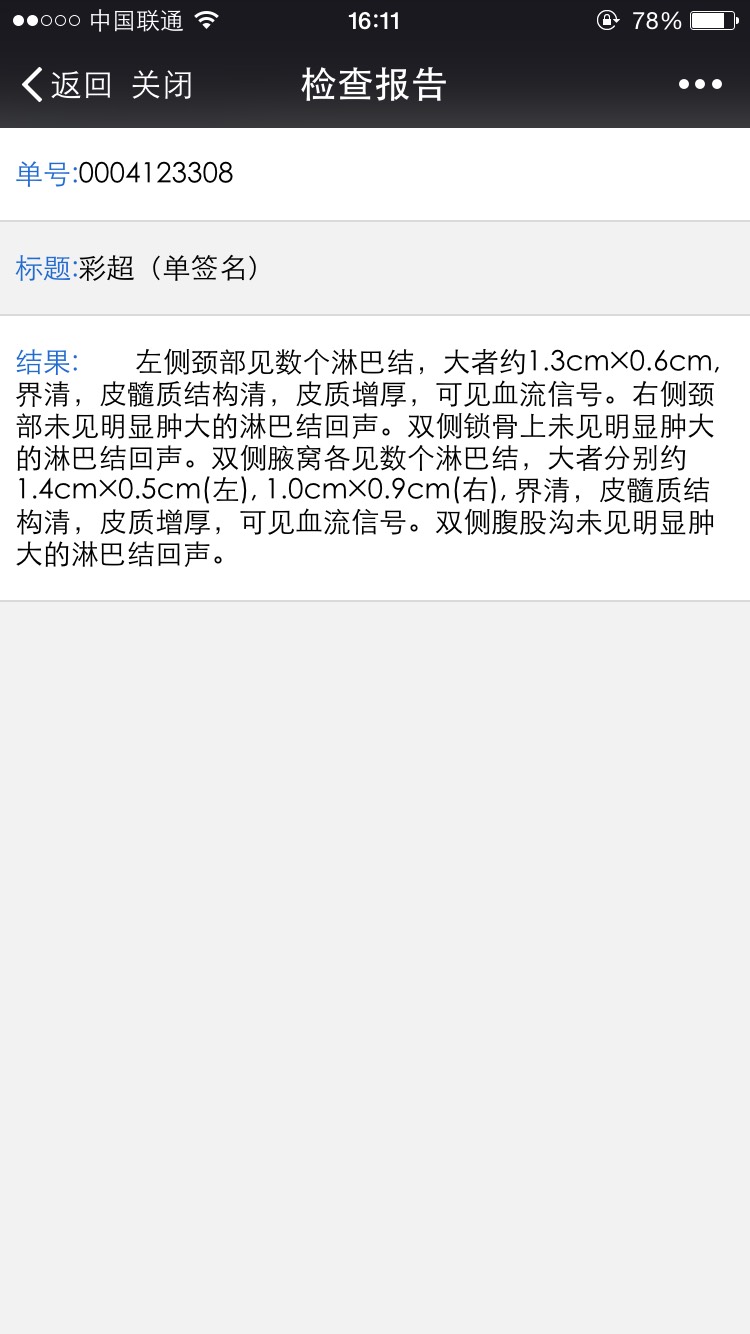 183609ocjcbxec8b33xldq.jpg