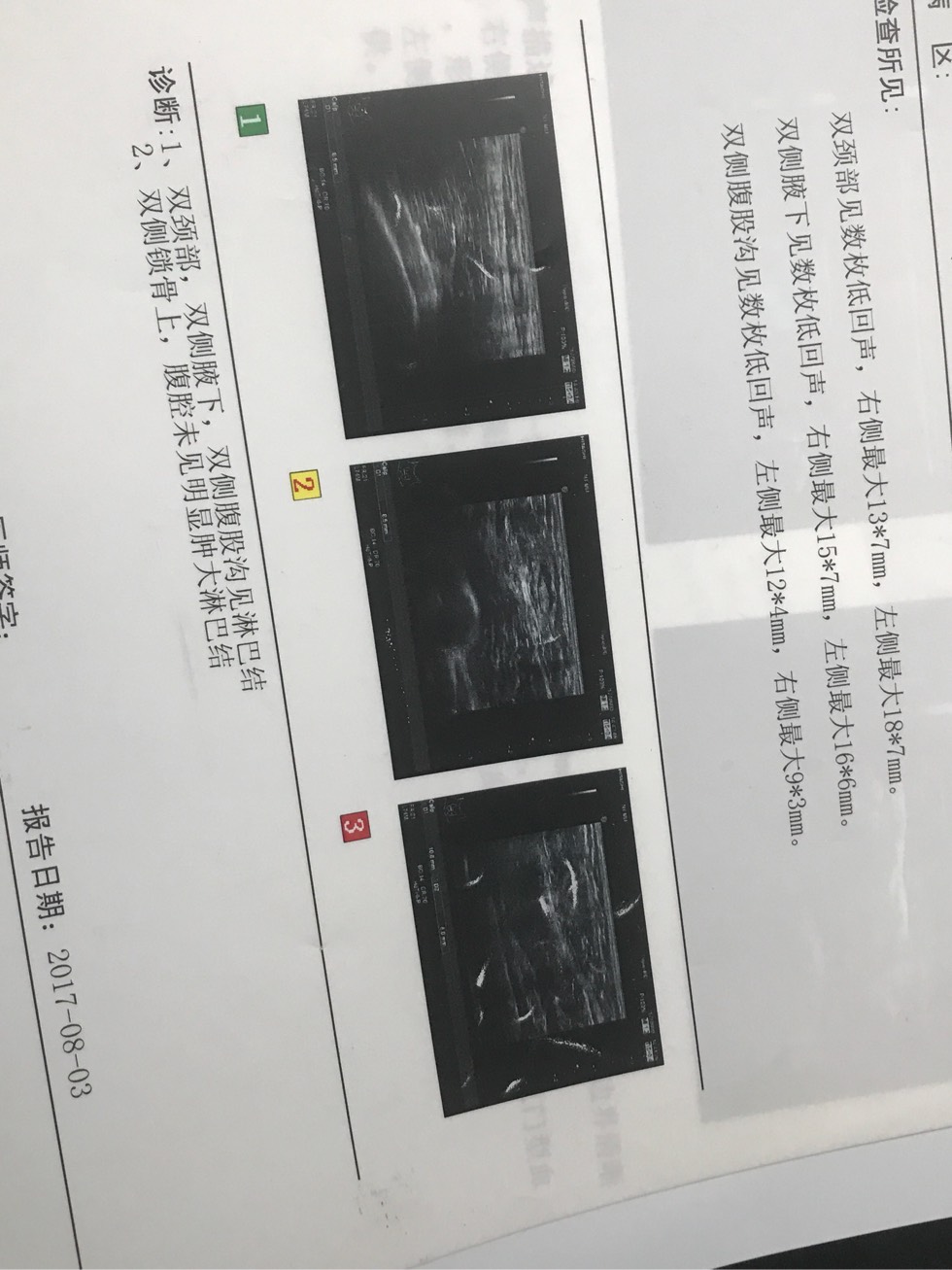 172202qy6geg60wxbbg155.jpg