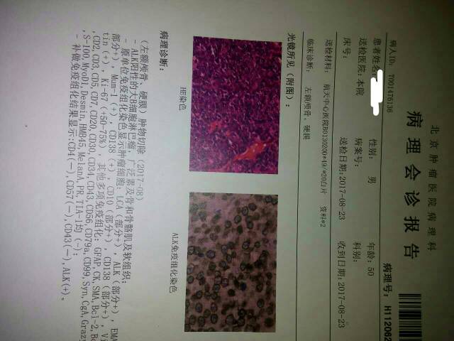 125446r8ane1cp5ua7bpb5.jpg