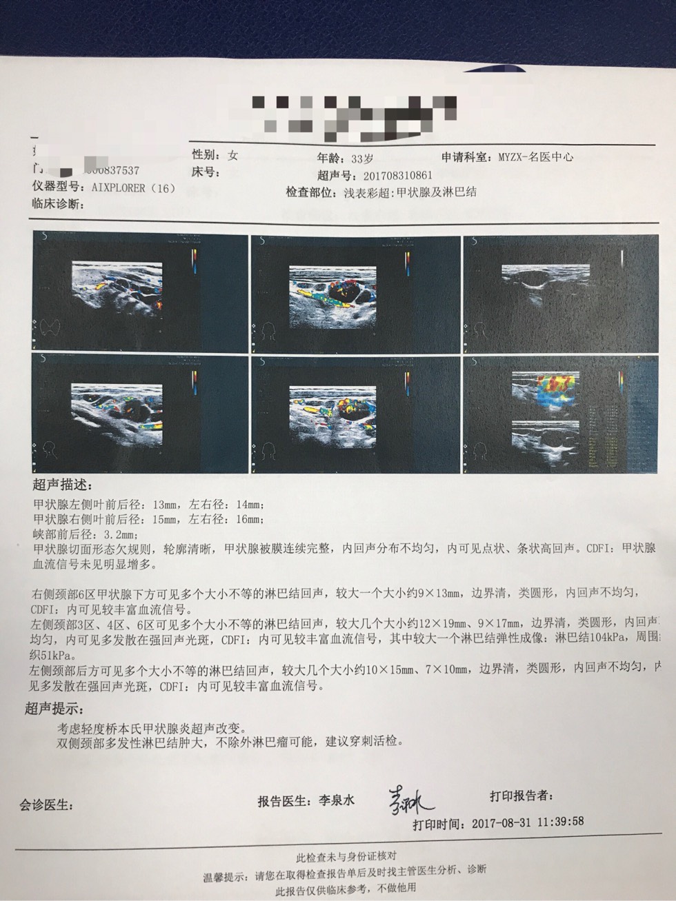 161305em55v8nb8sd85zvb.jpg