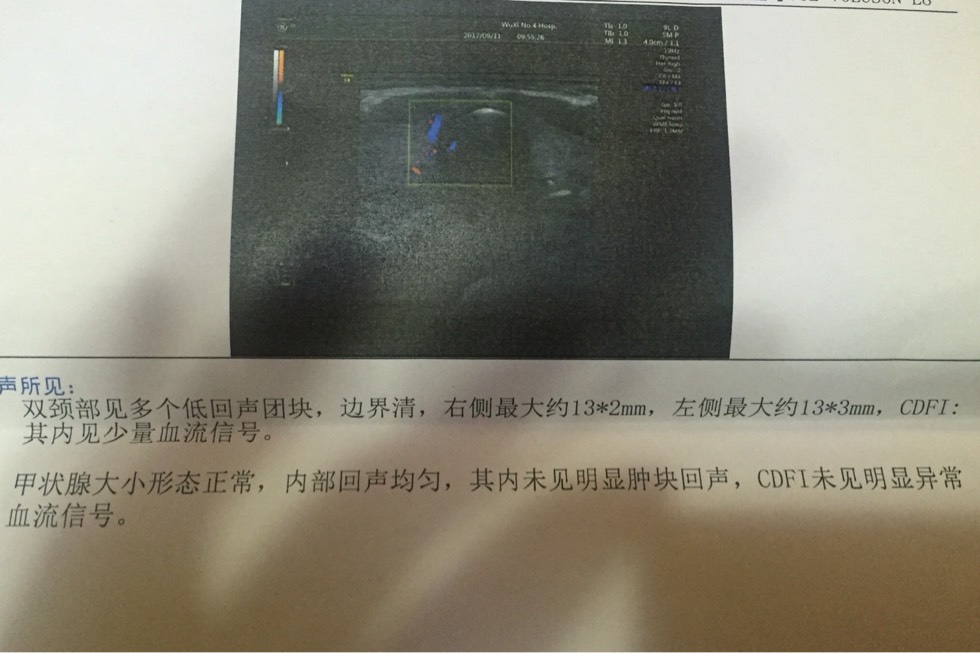 180239qyz51fn6qccbqeqa.jpg