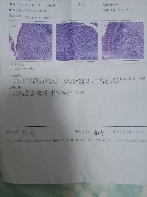 220454ejbcuaror6011aha.jpg