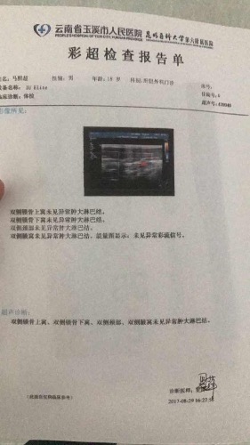 114EE028-A023-4D59-BB47-6AFA3B63C5AA-347-0000002067B71C34_tmp.jpg